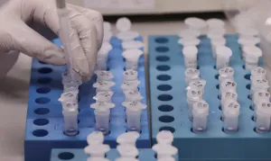 Avanço científico aponta possibilidade de corrigir trissomia 21 em ambiente laboratorial